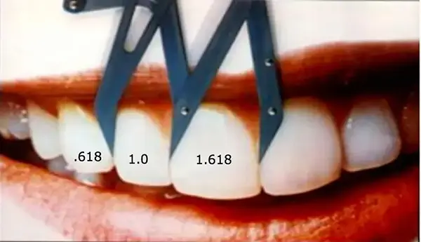The Fibonacci sequence seen in teeth